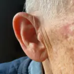 BTE Rechargeable Hearing Aids (Pair Of 2) - Image 2